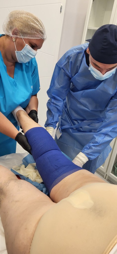 Flebectomia: Ce este, când e necesară și cum poți preveni&nbsp;varicele